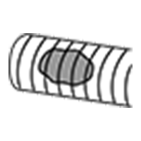 Locking Type